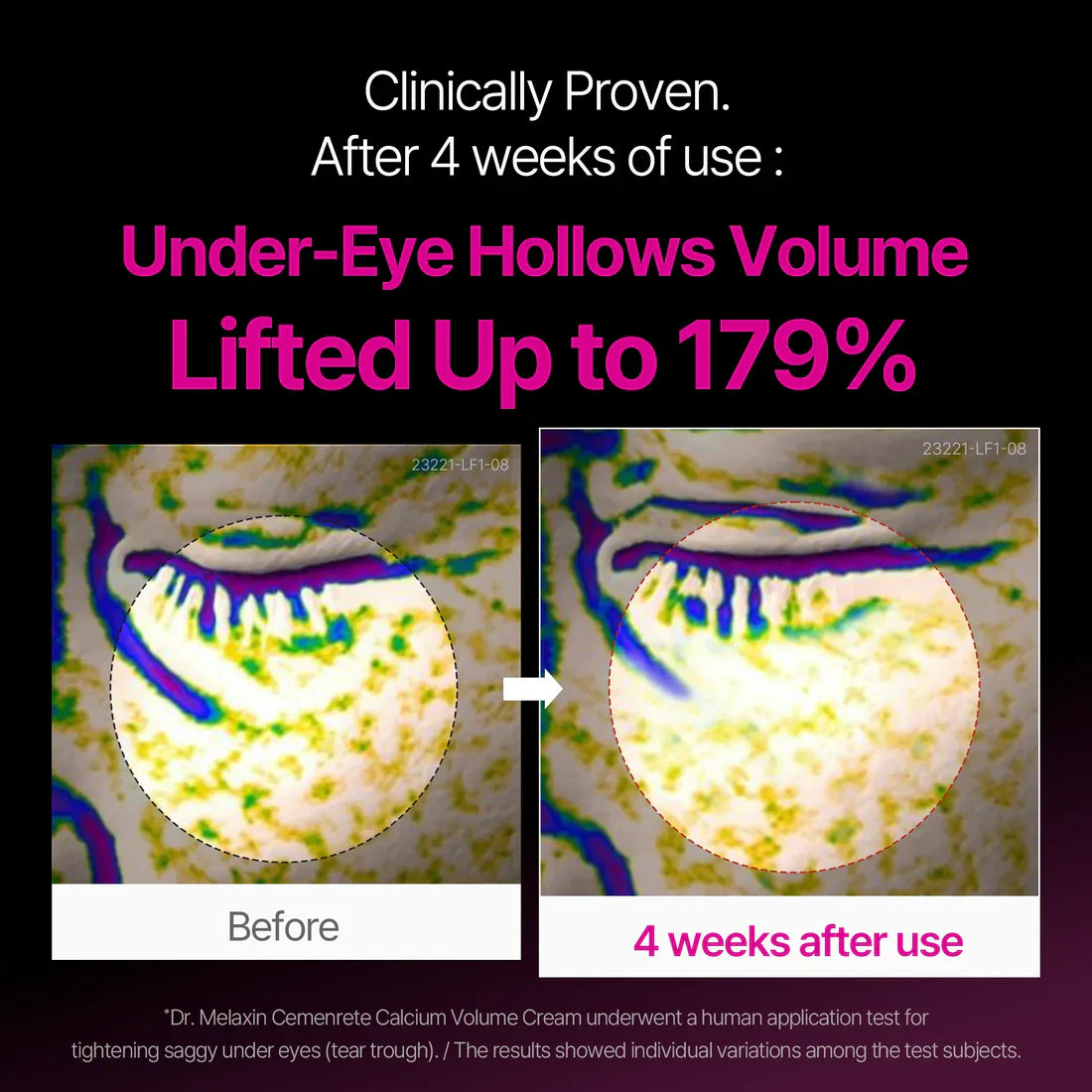 Eye Lift Calcium Repair Set