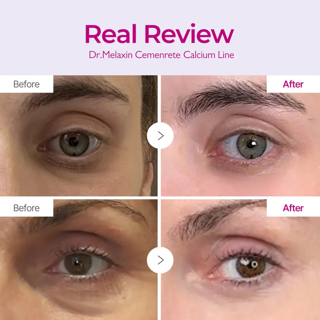 Eye Lift Calcium Repair Set