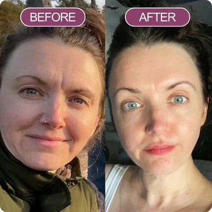 Eye Lift Calcium Repair Set