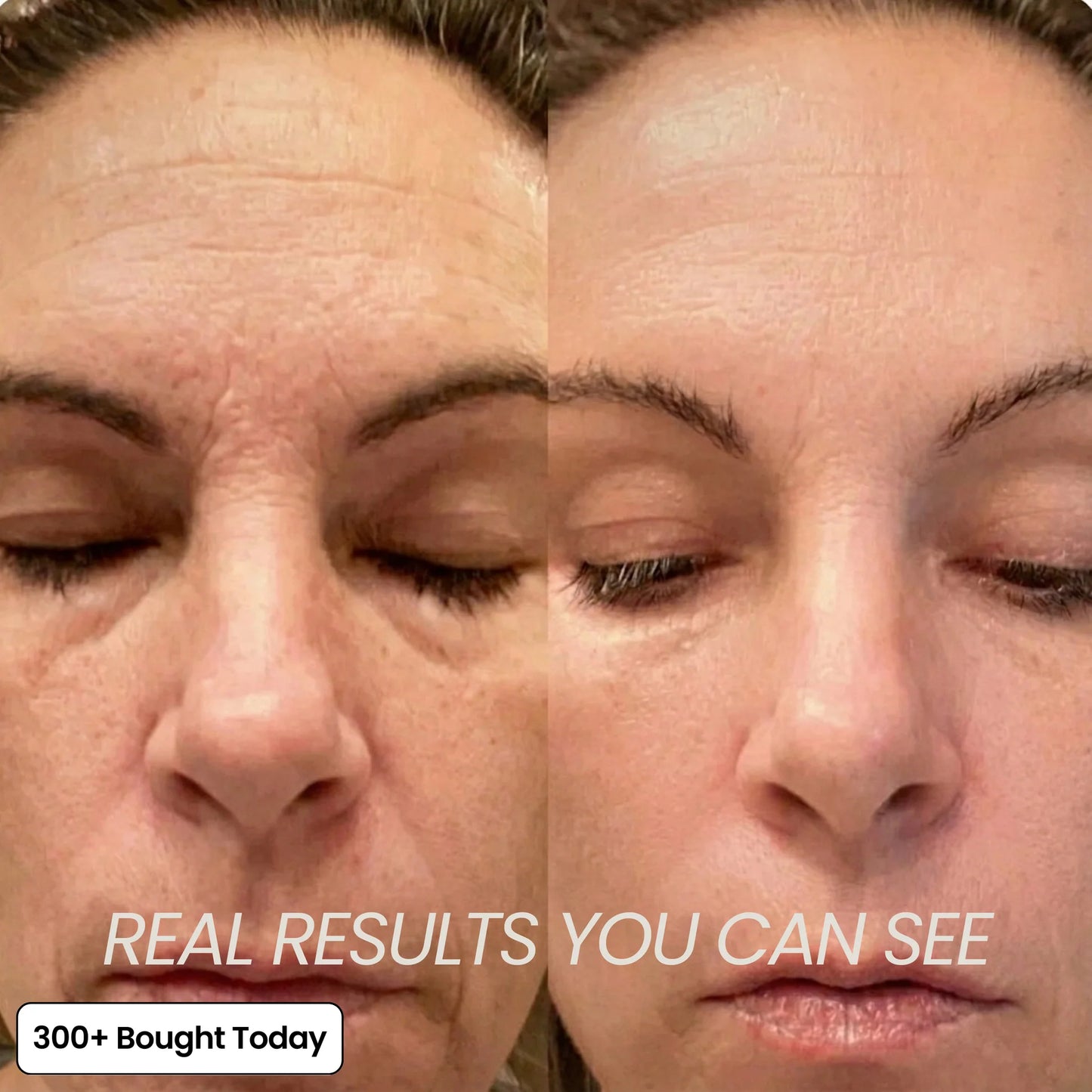 Repair Balm & Collagen Booster