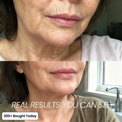 Repair Balm & Collagen Booster