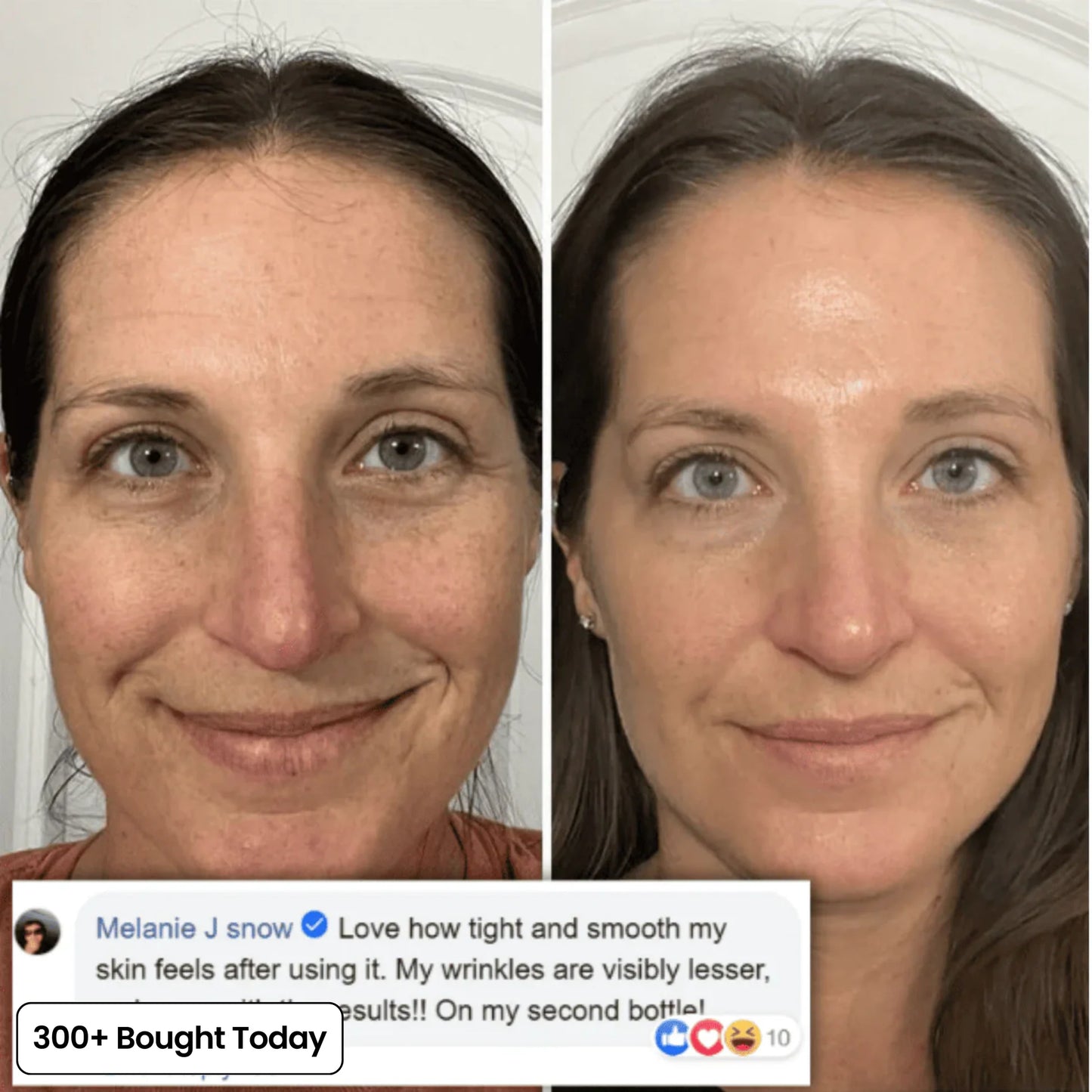 Repair Balm & Collagen Booster