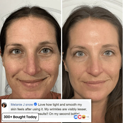 Repair Balm & Collagen Booster