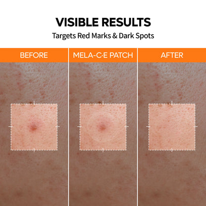 ClearFix Blemish & Spot Patch Duo