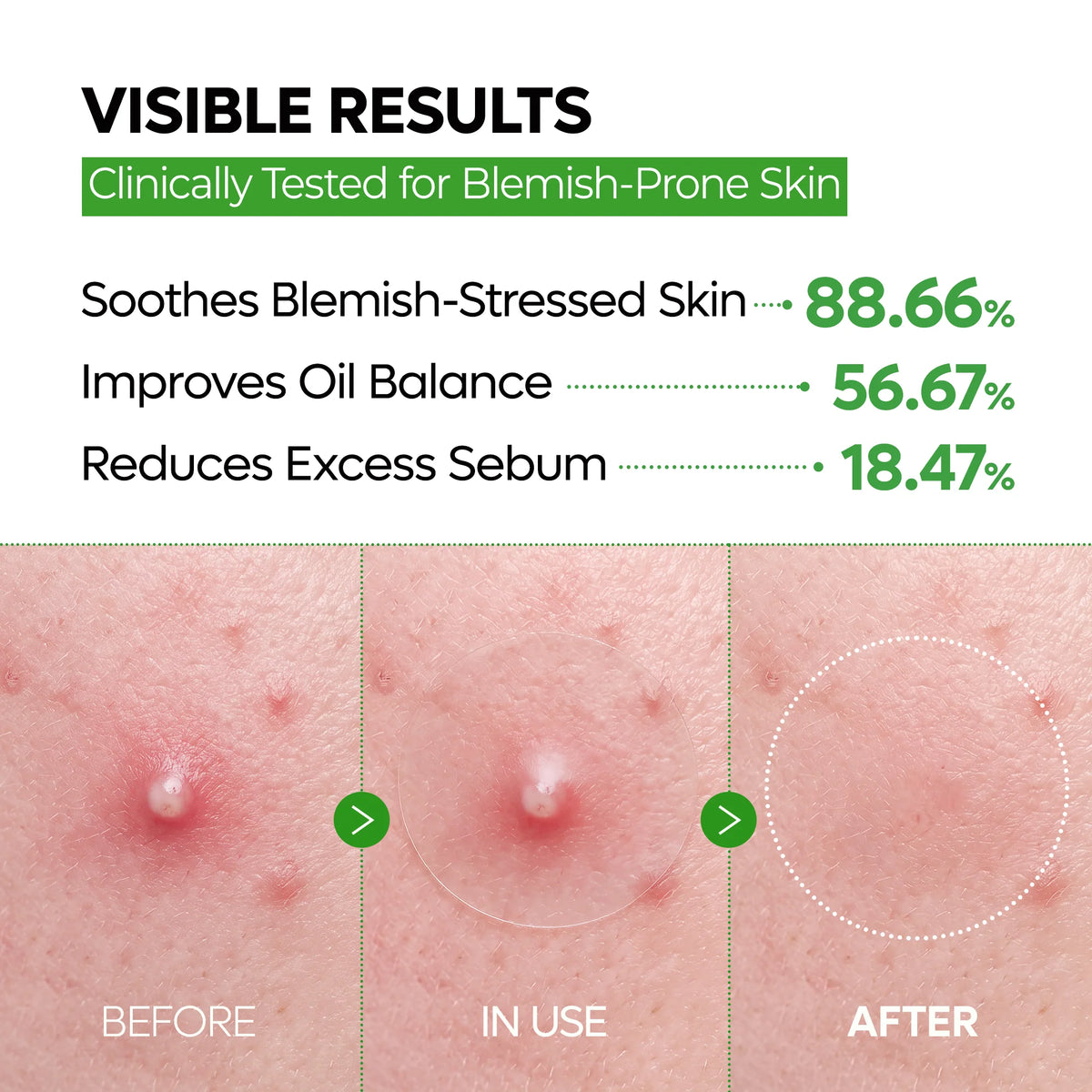 ClearFix Blemish & Spot Patch Duo